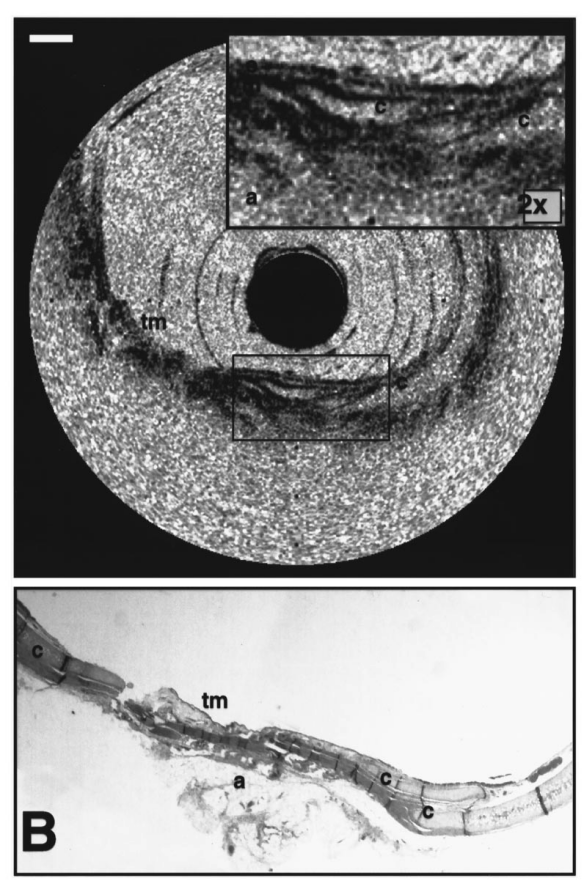 Lasertechnik (3)